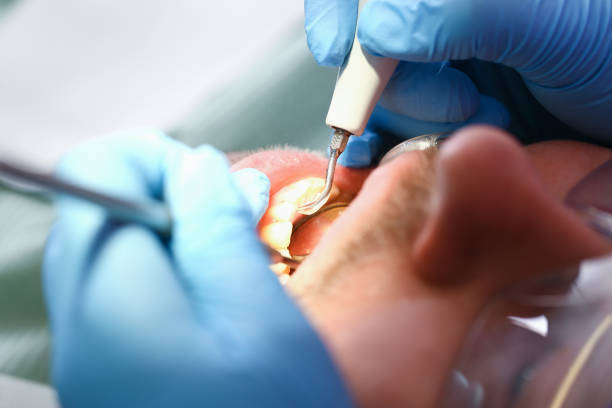 Best Cracked Tooth Emergency Dentist  in North Kingsville, OH