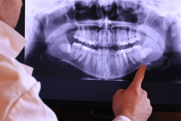Best Emergency Tooth Extraction  in North Kingsville, OH