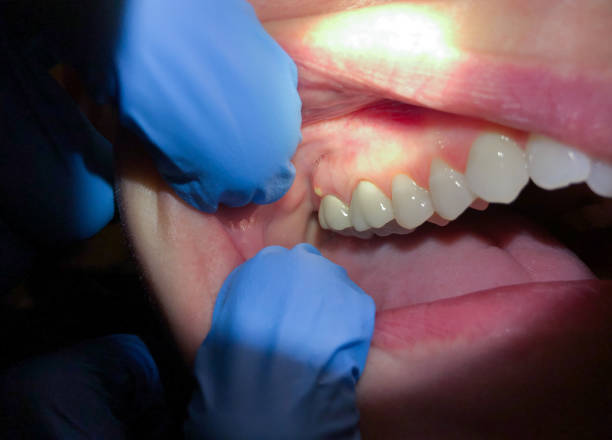 Best Emergency Dental Services Near Me  in North Kingsville, OH