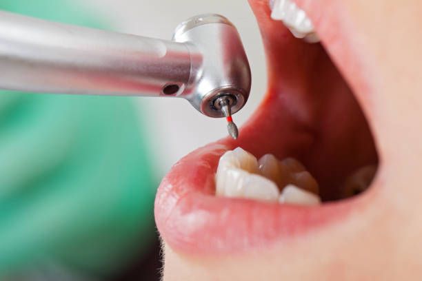 Tooth Infection Emergency Dentist in OH